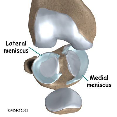 knee-meniscus-surgery-injury