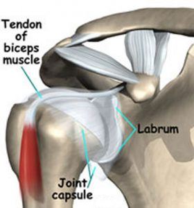 labral-tear-shoulder-injury