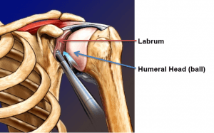 Dr Tony | Sawtooth Orthopedics | Shoulder Labral Tear Repair